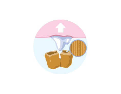 krmivo pre domáce zvieratá odstraňuje tvorbu zubov ilustrácie